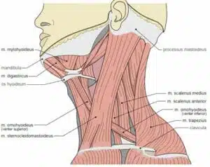 myofascial pain